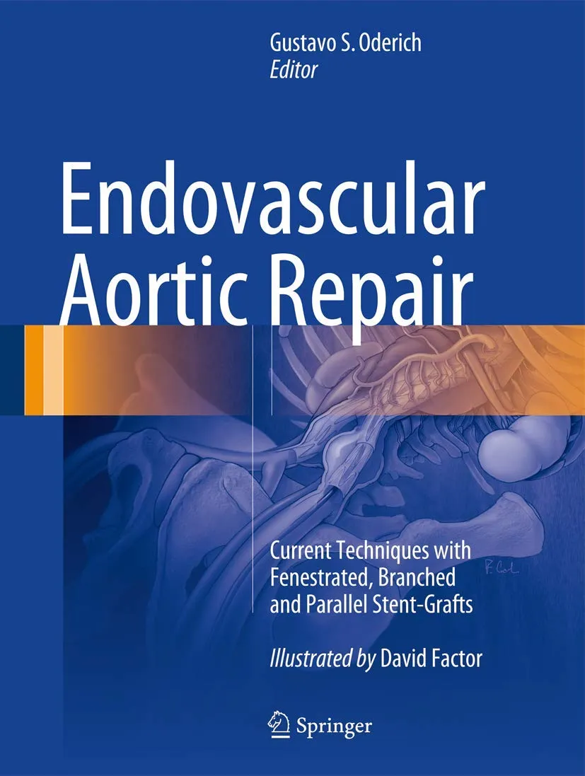 Endovascular Aortic Repair | Hardcover