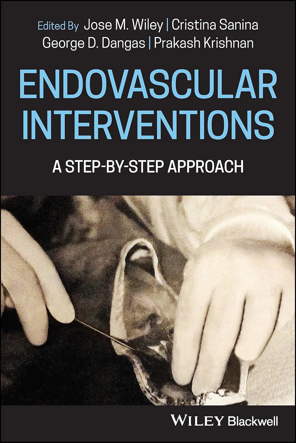 Endovascular Interventions A Step By Step Approach | Paperback