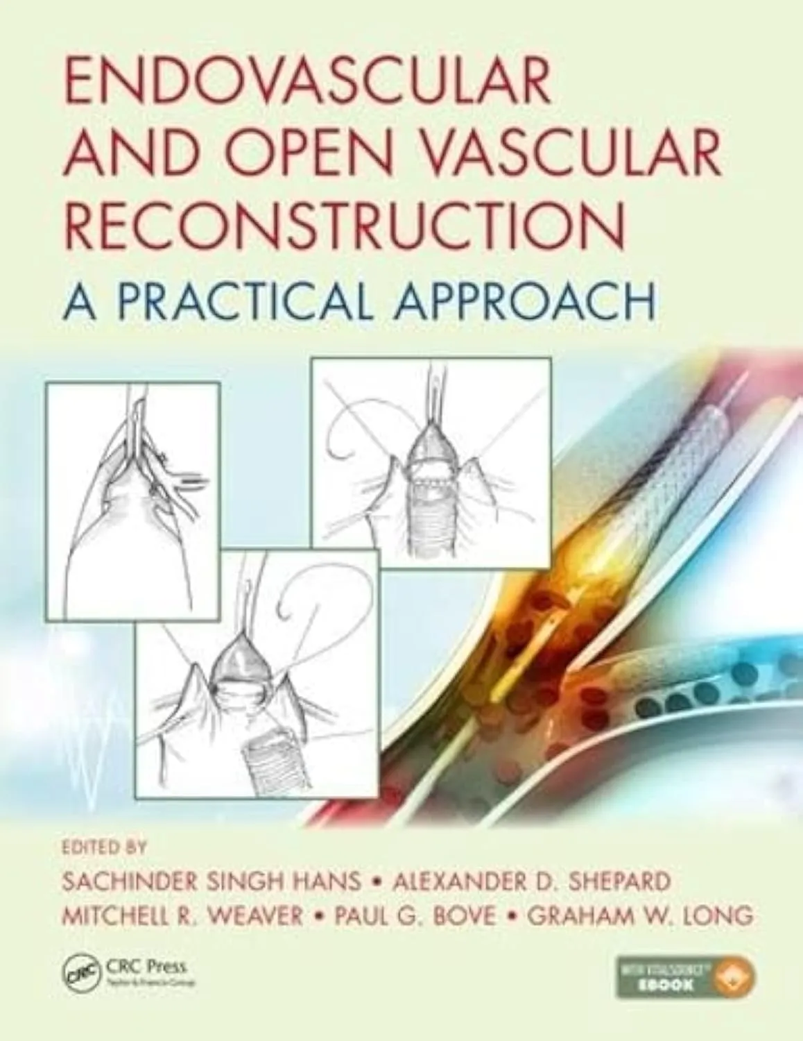 Endovascular and Open Vascular Reconstruction A Practical Approach | Hardcover