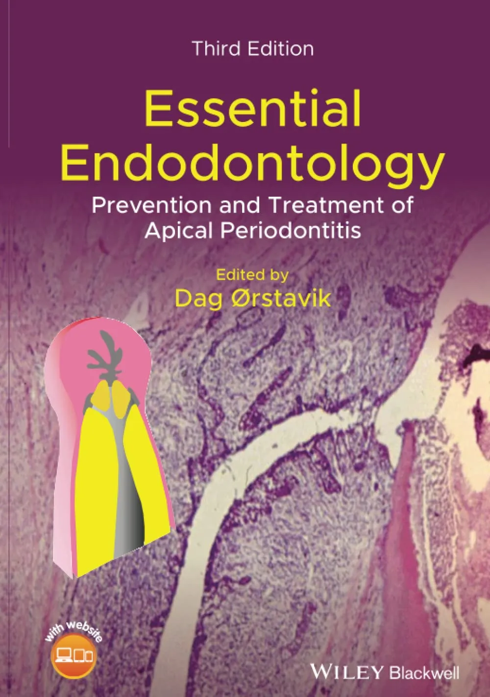 Essential Endodontology Prevention And Treatment Of Apical Periodontitis Third Edition | Hardcover
