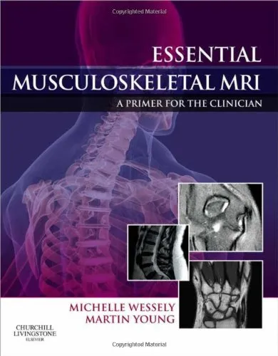 Essential Musculoskeletal MRI A Primer for the Clinican | Hardcover