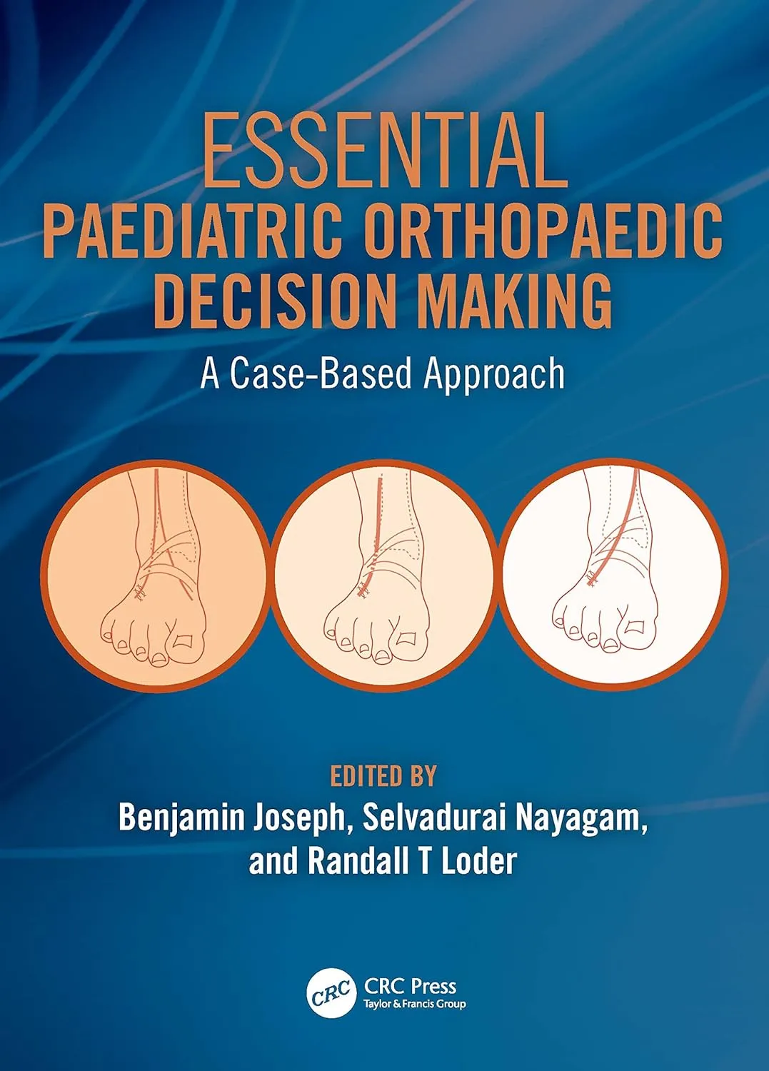 Essential Paediatric Orthopaedic Decision Making A Case Based Approach | Paperback