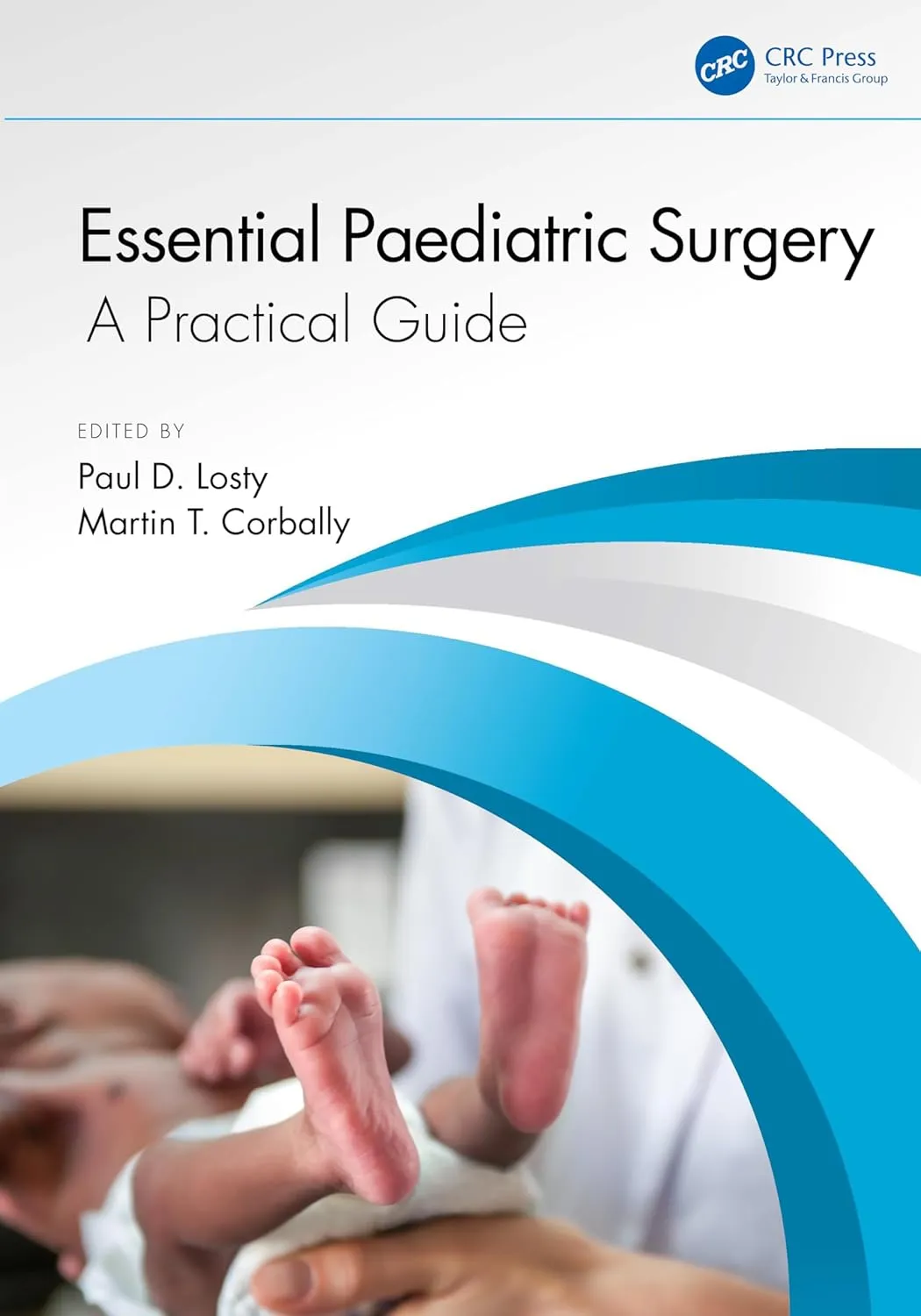 Essential Paediatric Surgery A Practical Guide | Paperback