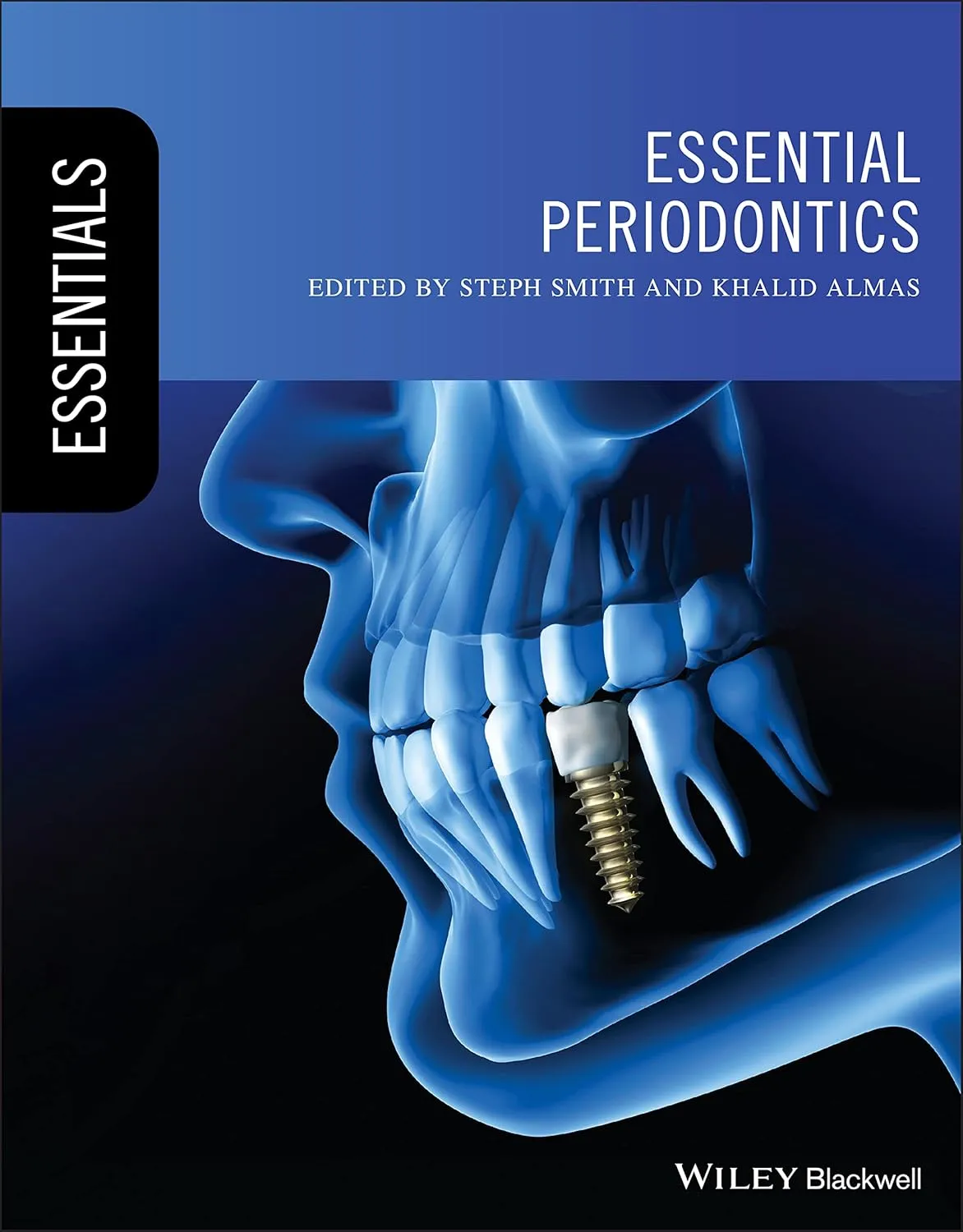 Essential Periodontics | Paperback