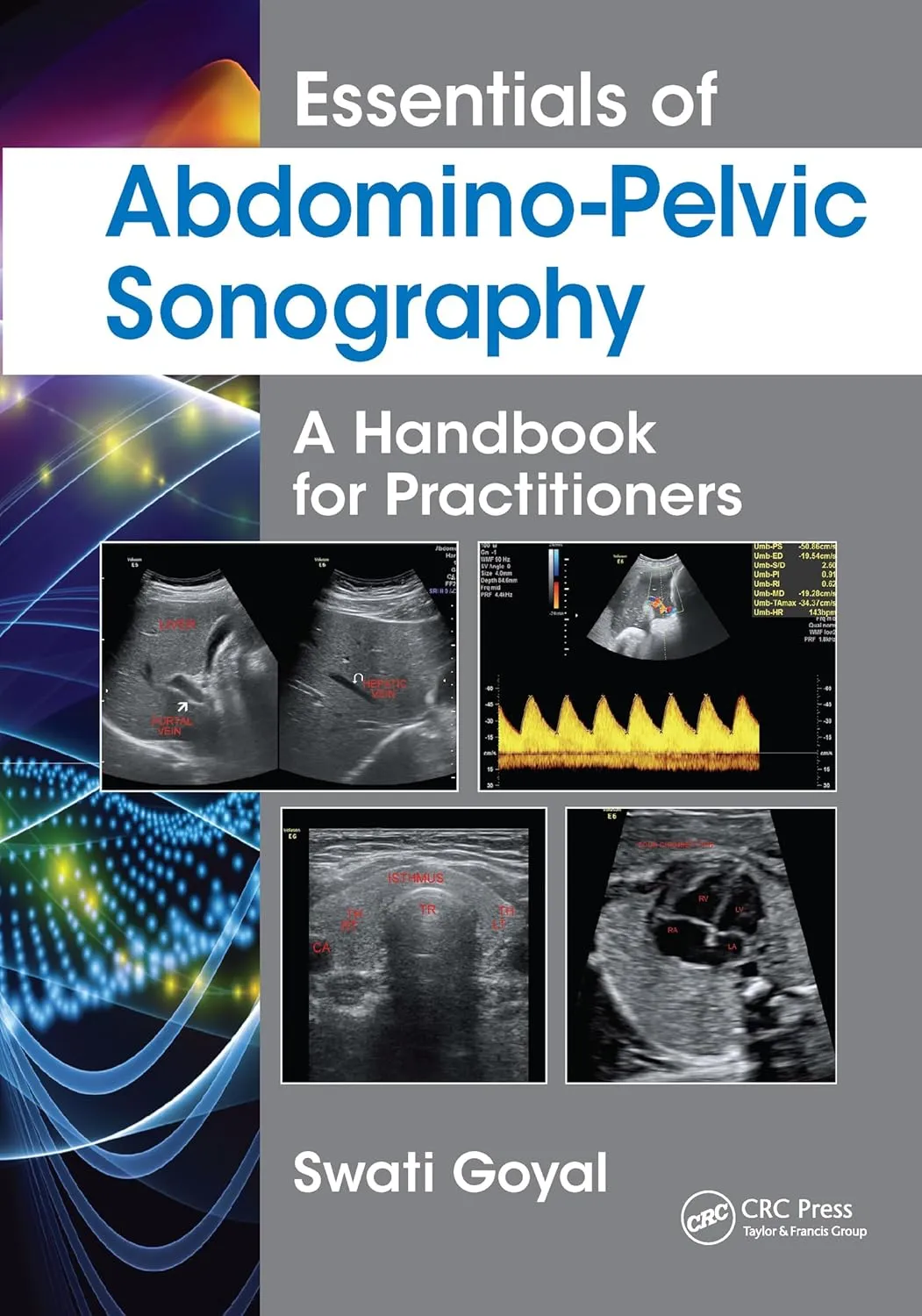 Essentials of Abdomino-Pelvic Sonography A Handbook for Practitioners | Paperback