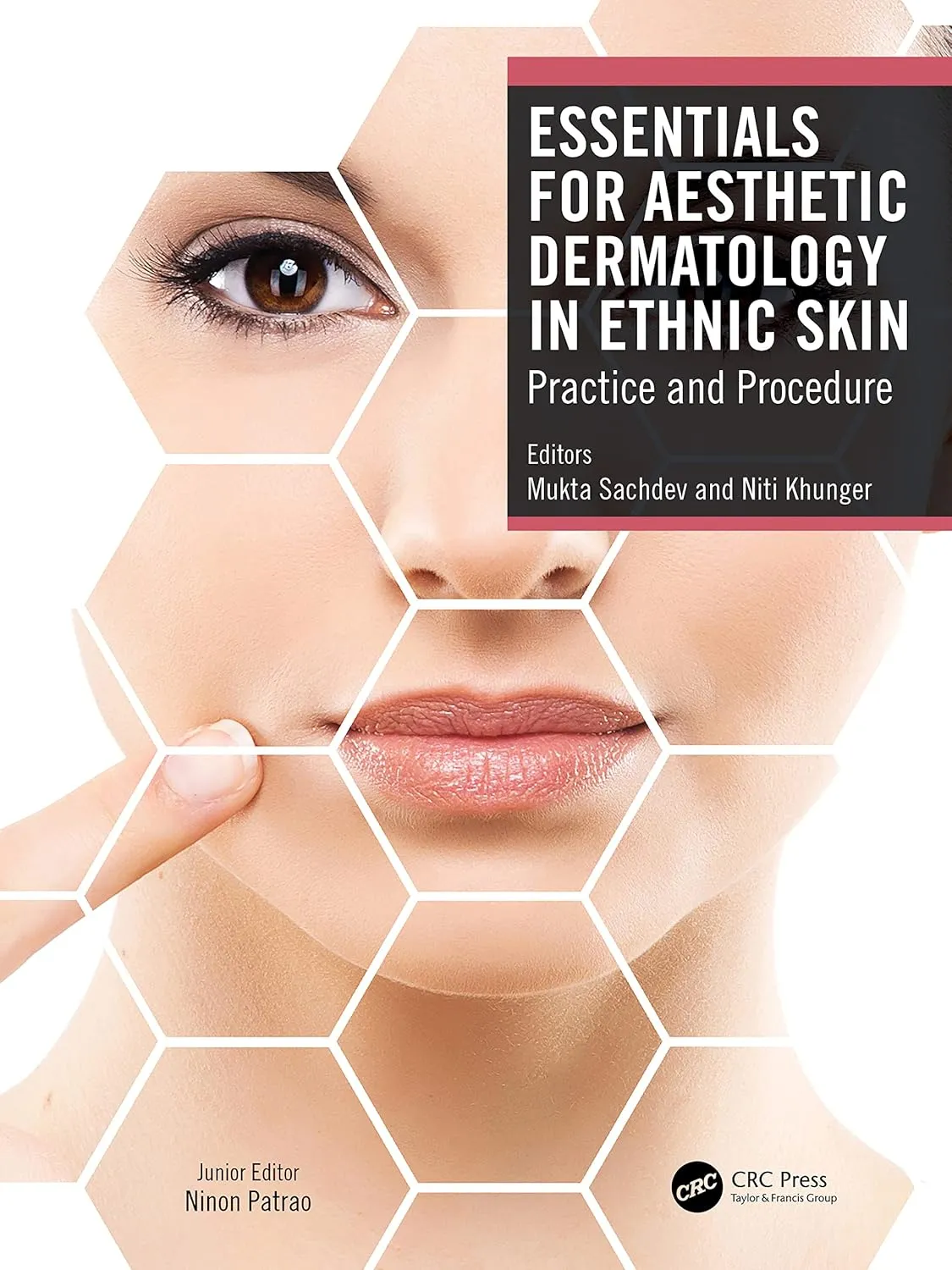 Essentials For Aesthetic Dermatology In Ethnic Skin Practice And Procedure | Hardcover