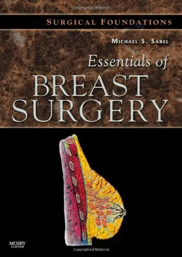 Essentials of Breast Surgery A Volume in the Surgical Foundations Series | Hardcover