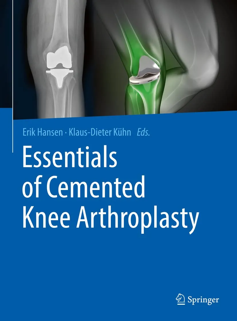 Essentials of Cemented Knee Arthroplasty | Hardcover