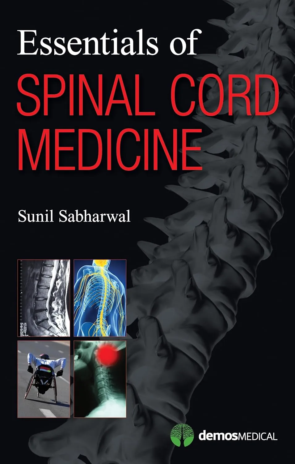 Essentials of Spinal Cord Medicine | Paperback