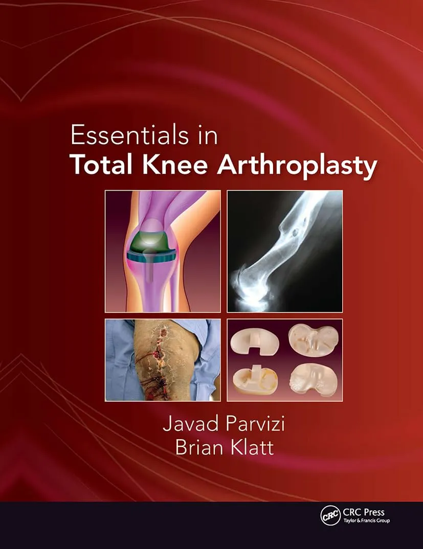 Essentials in Total Knee Arthroplasty | Hardcover