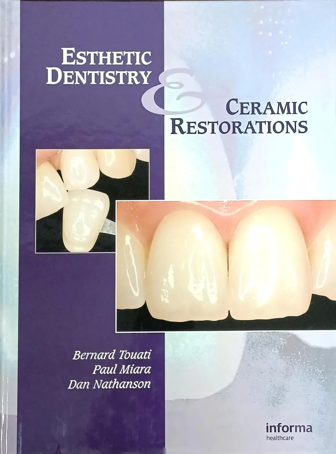 Esthetic Dentistry and Ceramic Restorations | Hardcover