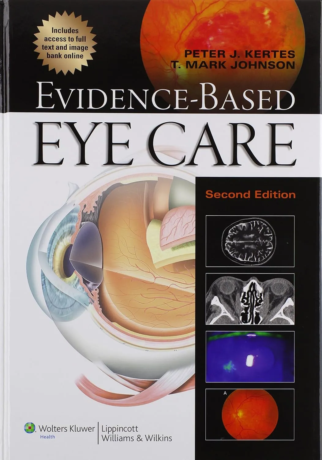 Evidence-Based Eye Care | 2nd Edition | Hardcover