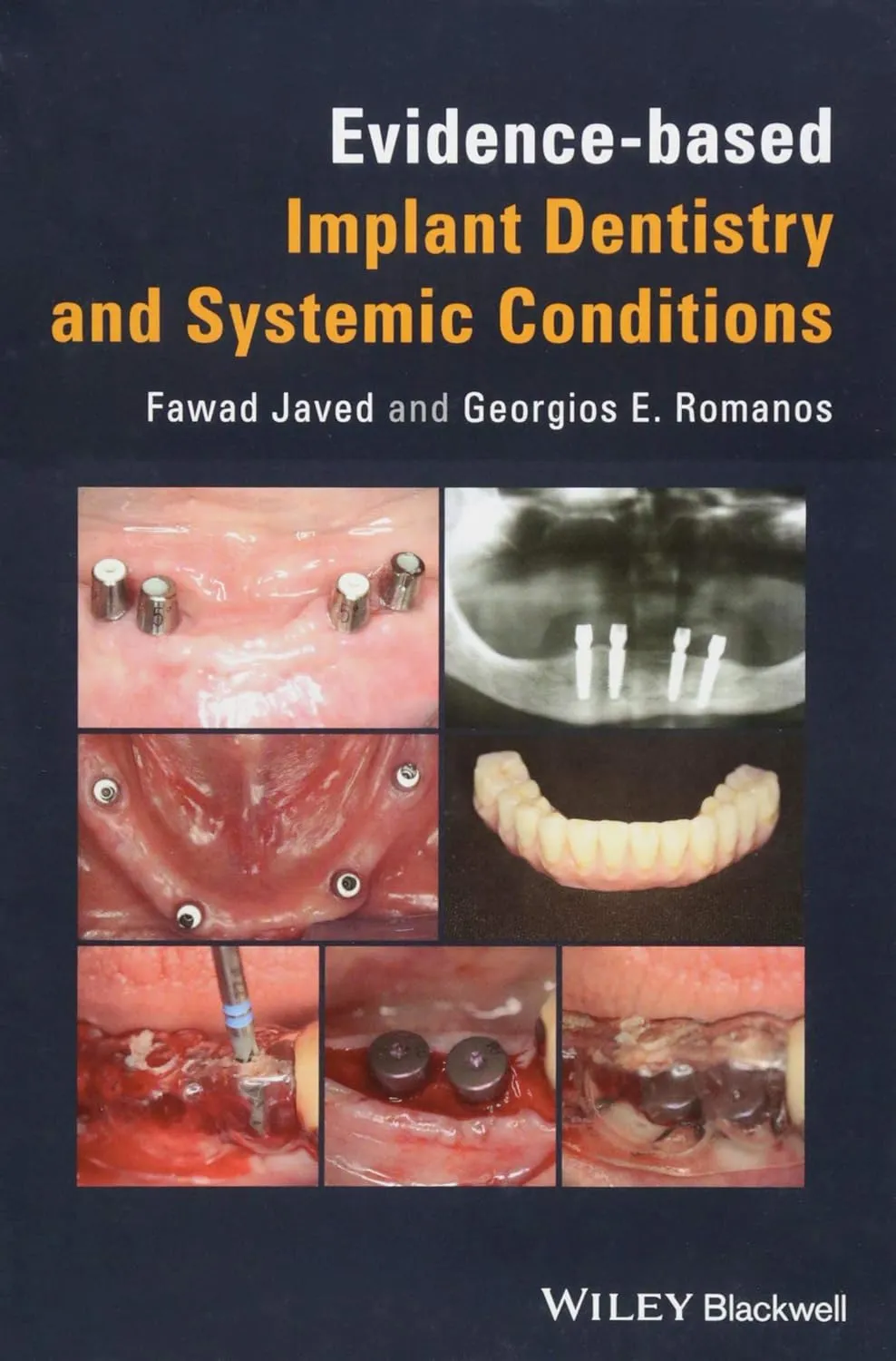 Evidence-Based Implant Dentistry and Systemic Conditions | Hardcover