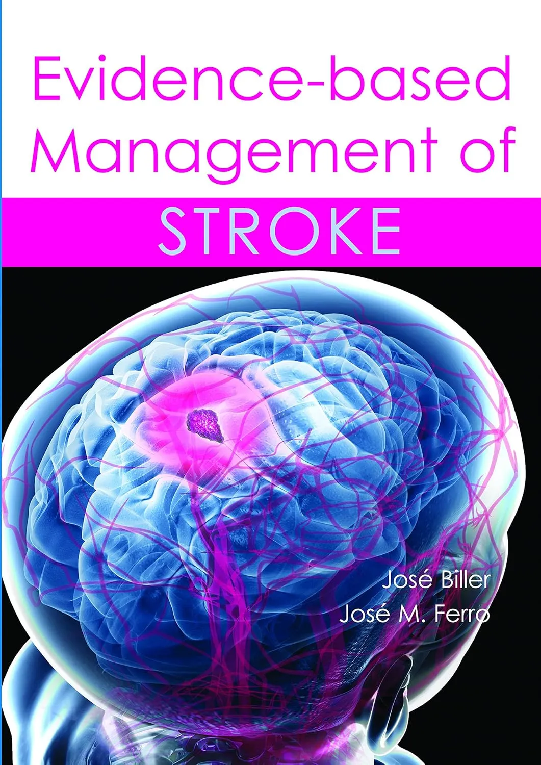 Evidence-based Management of Stroke | Hardcover