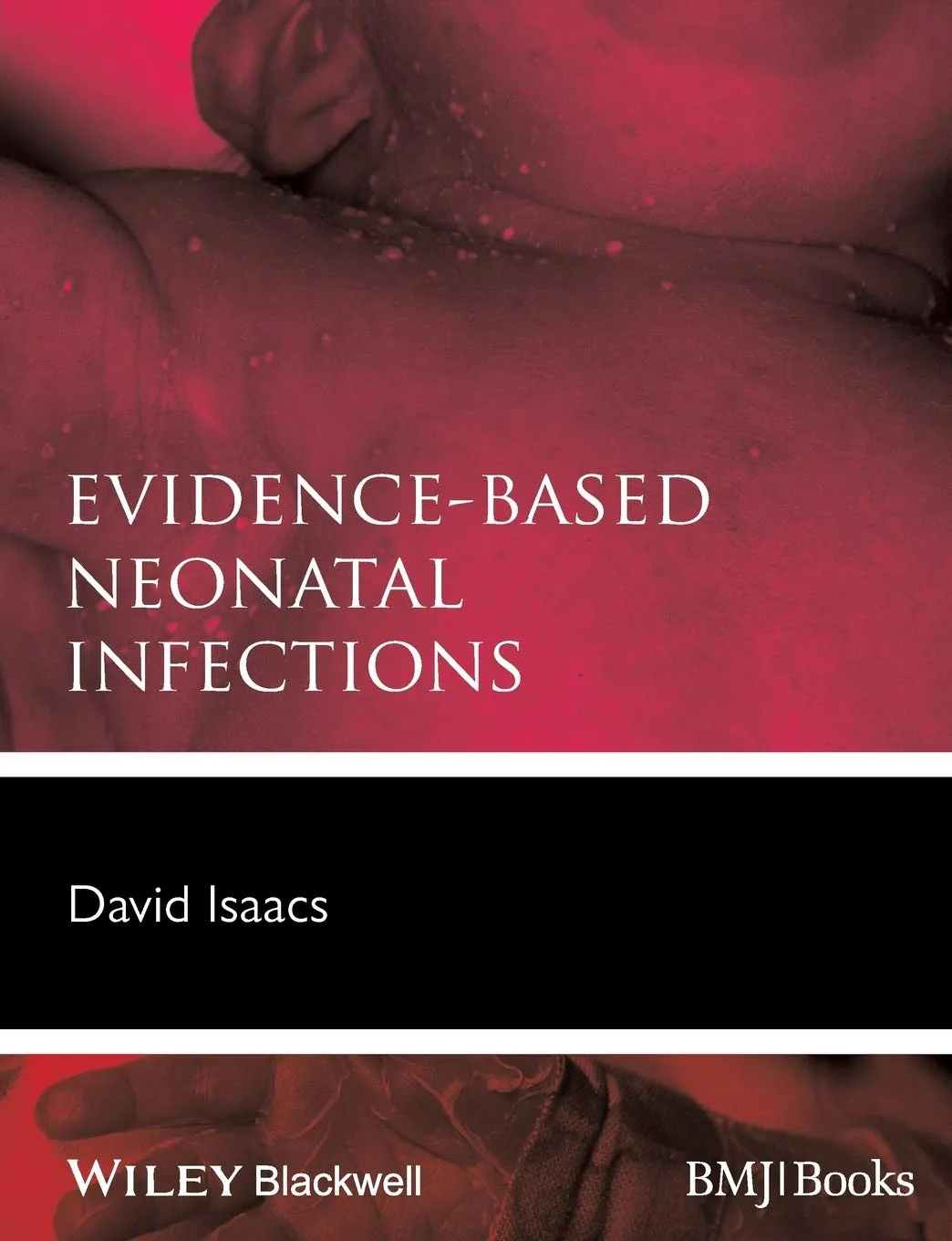 Evidence-Based Neonatal Infections | Paperback