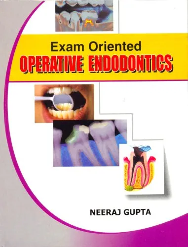Exam Oriented Operative Endodontics | Paperback
