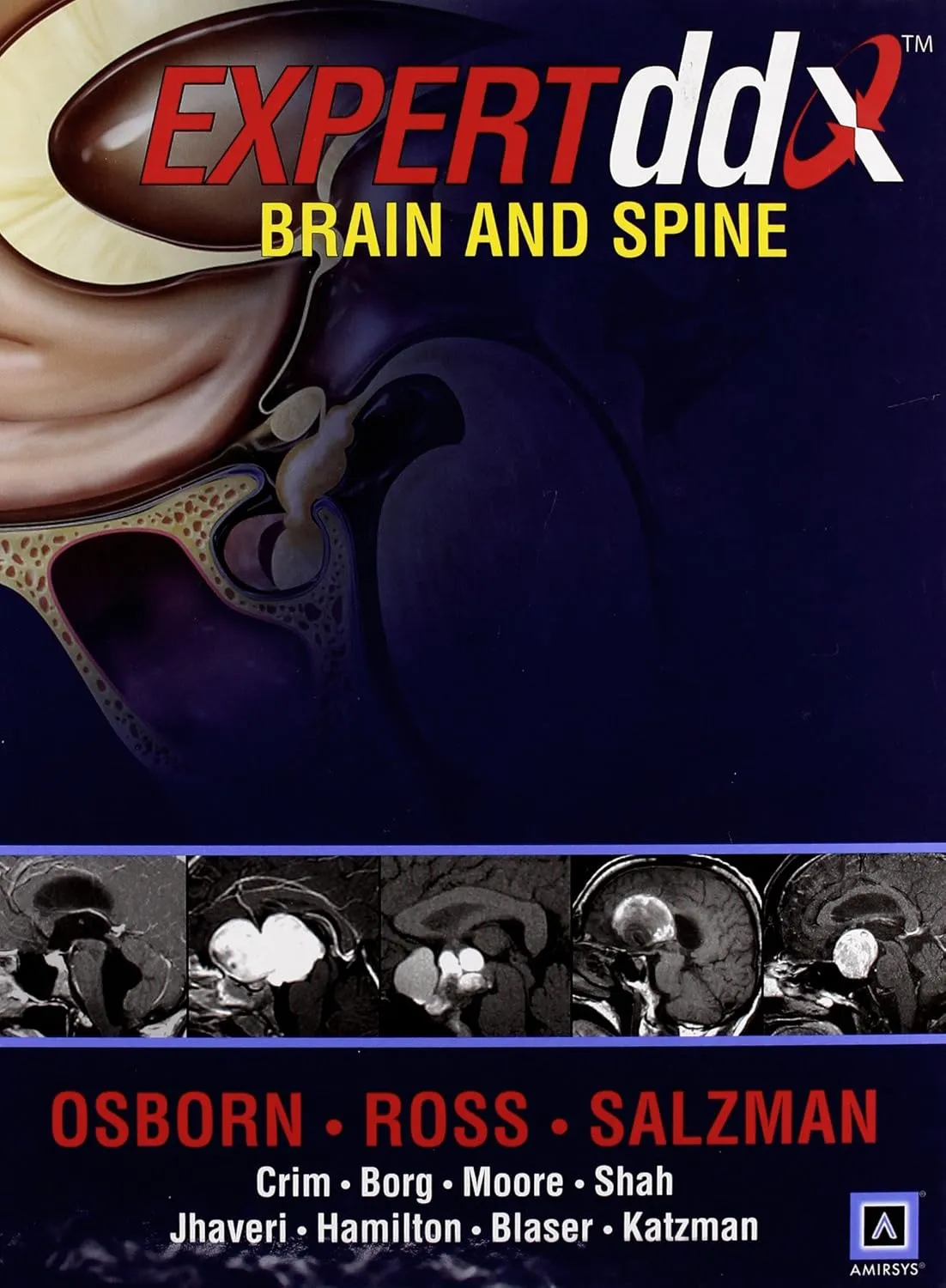 Expert dd Brain and Spine | Hardcover