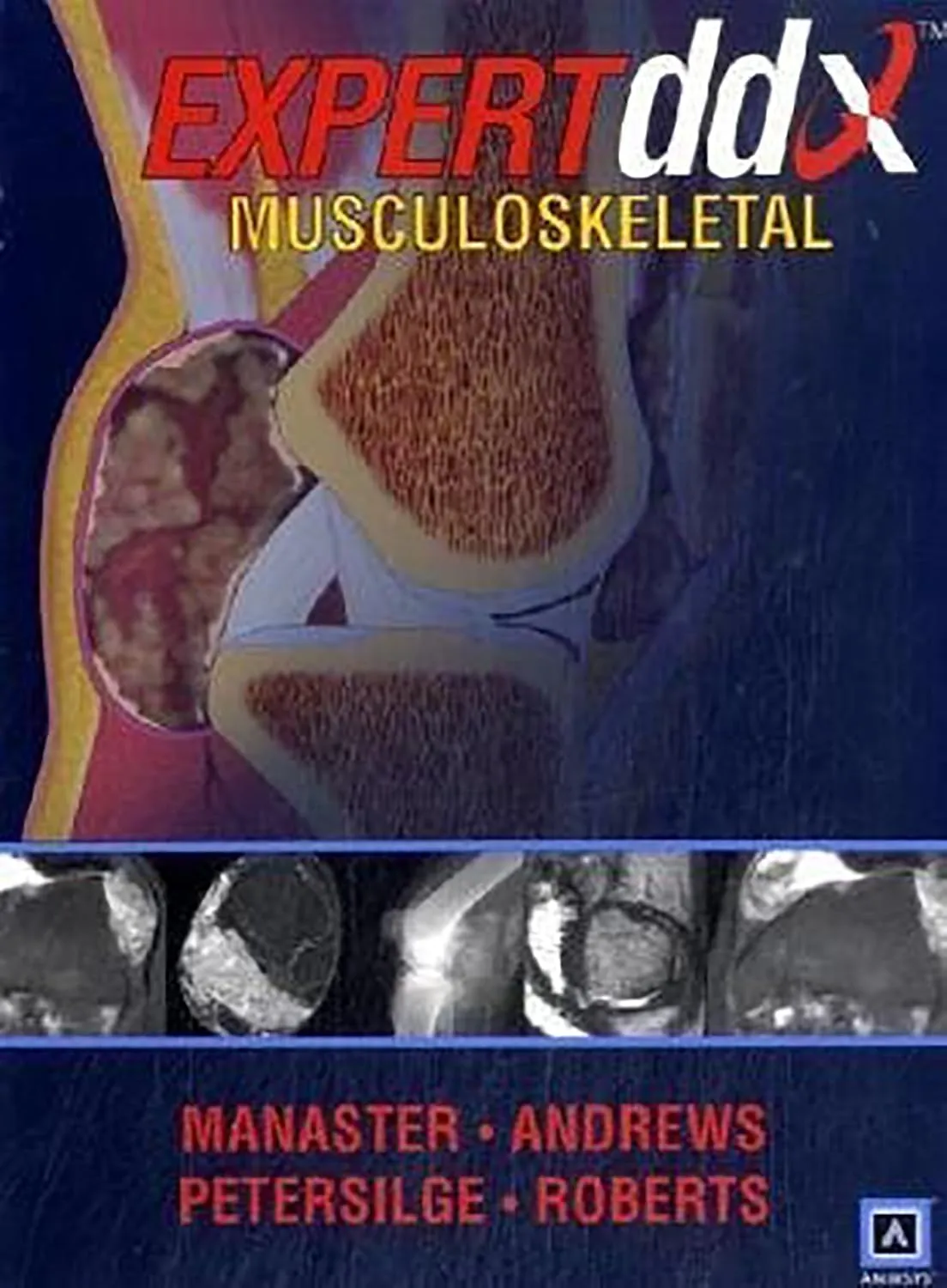 Expert dd Musculoskeletal Differential Diagnosis Series | Hardcover