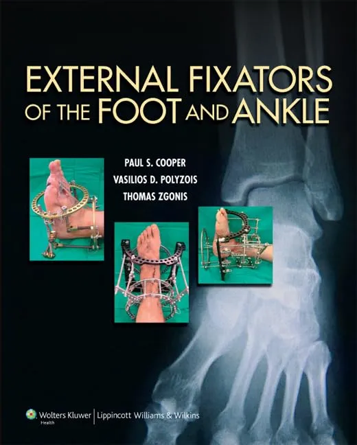 External Fixators of the Foot and Ankle | Hardcover