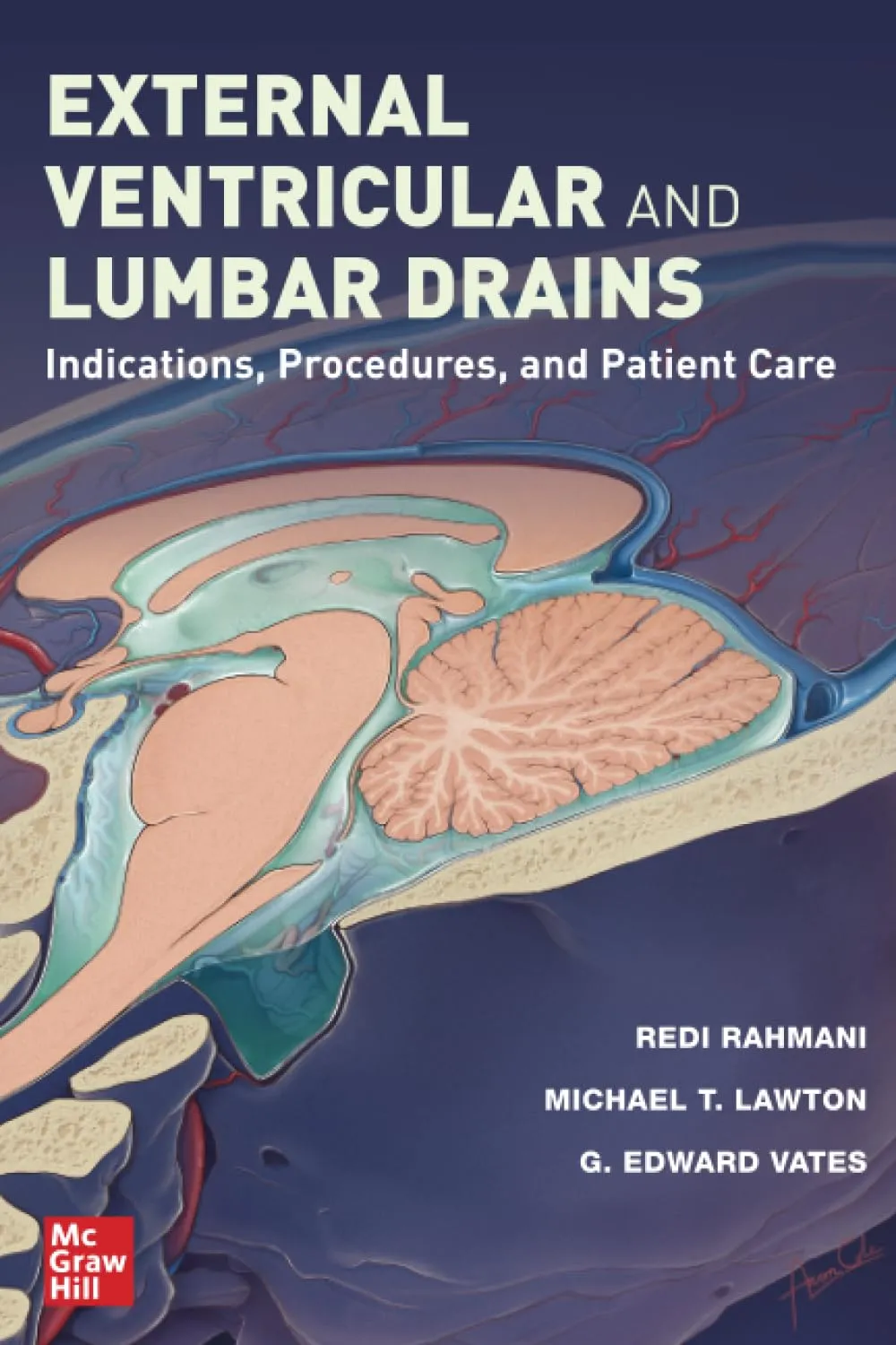 External Ventricular And Lumbar Drains Indications Procedures And Patient Care | Paperback