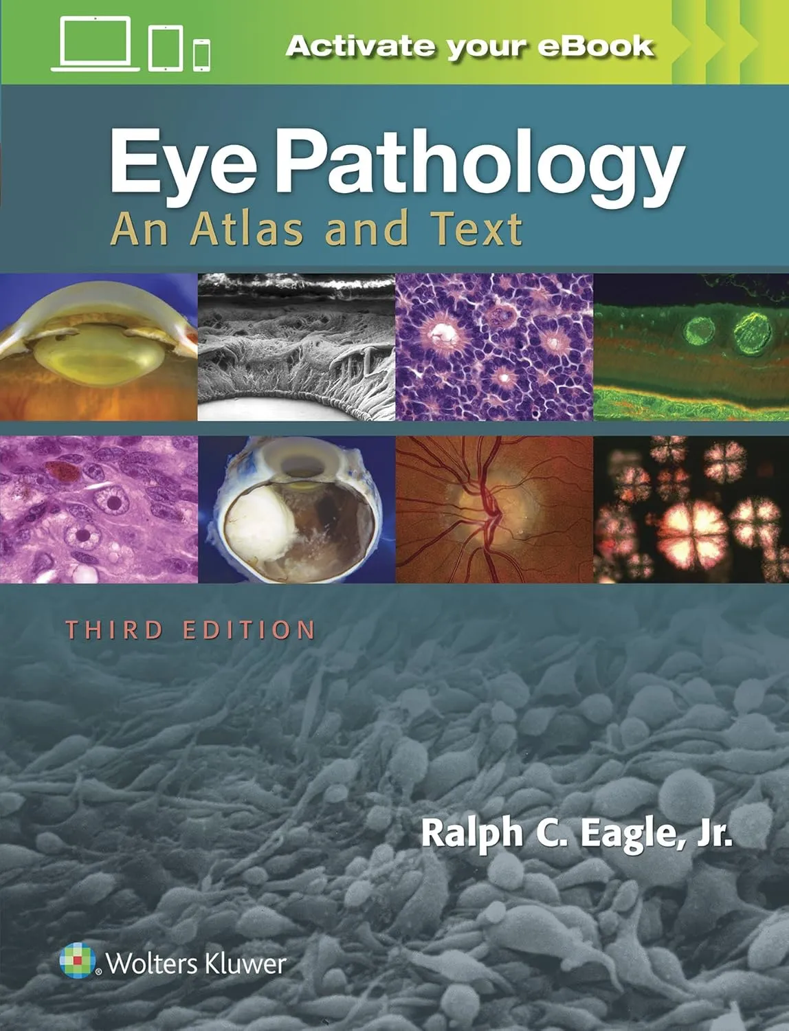 Eye Pathology An Atlas and Text | Third Edition | Hardcover