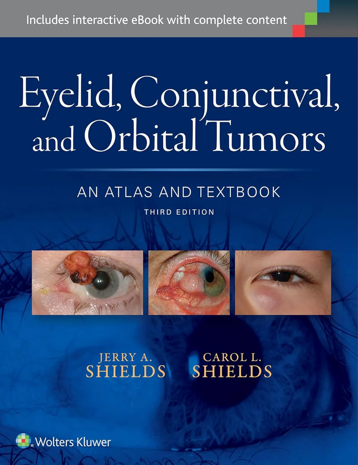 Eyelid | Conjuctival | and Orbital Tumors | Third Edition | Hardcover