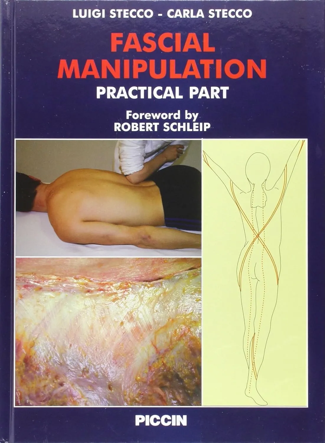 Fascial Manipulation Practical Part | Hardcover