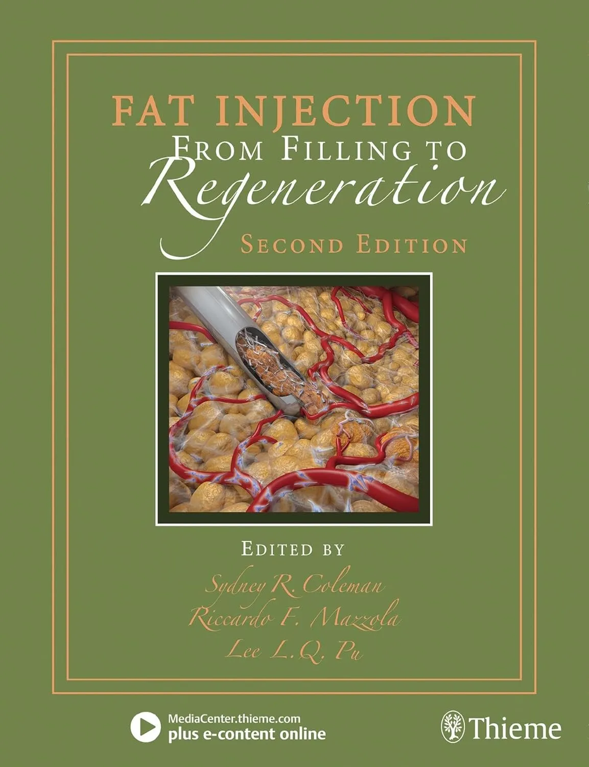 Fat Injection from Filling to Regeneration | Hardcover
