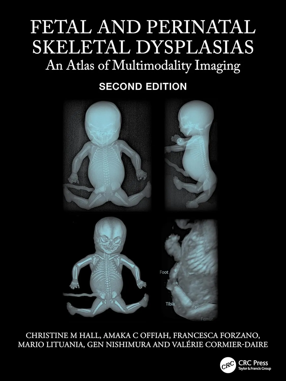 Fetal And Perinatal Skeletal Dysplasias An Atlas Of Multimodality Imaging 2nd Edition | Hardcover
