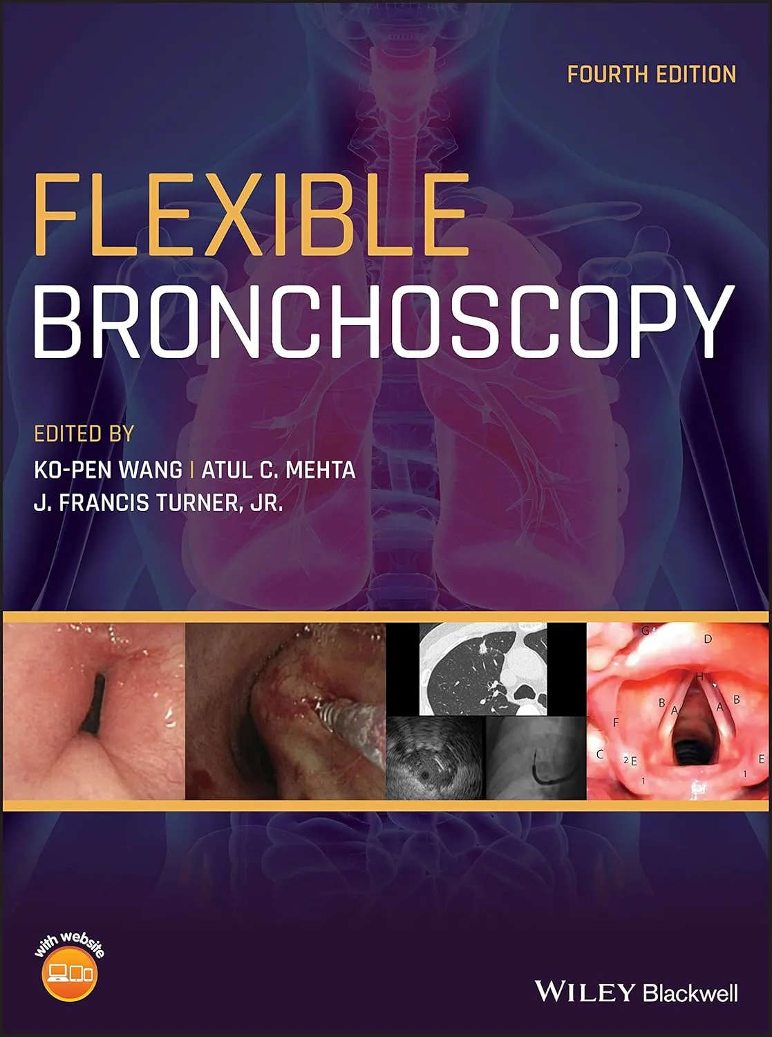 Fiexible Bronchoscopy 4th Edition | Hardcover