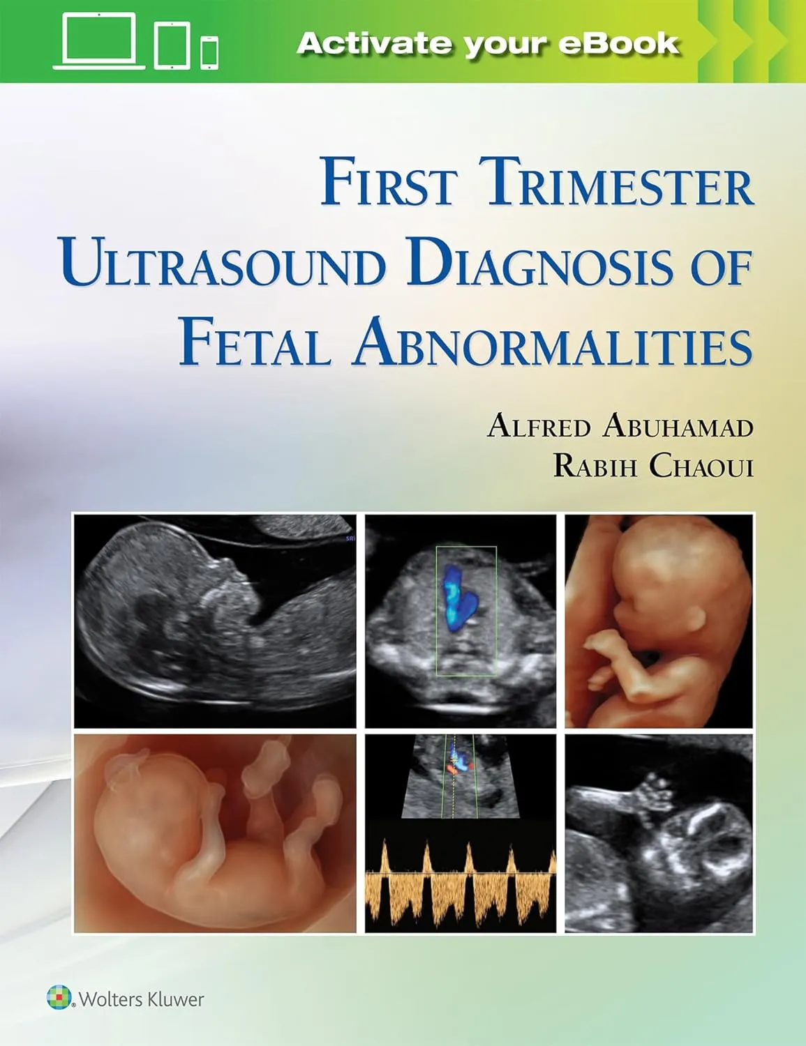 First Trimester Ultrasound Diagnosis of Fetal Abnormalities | Hardcover