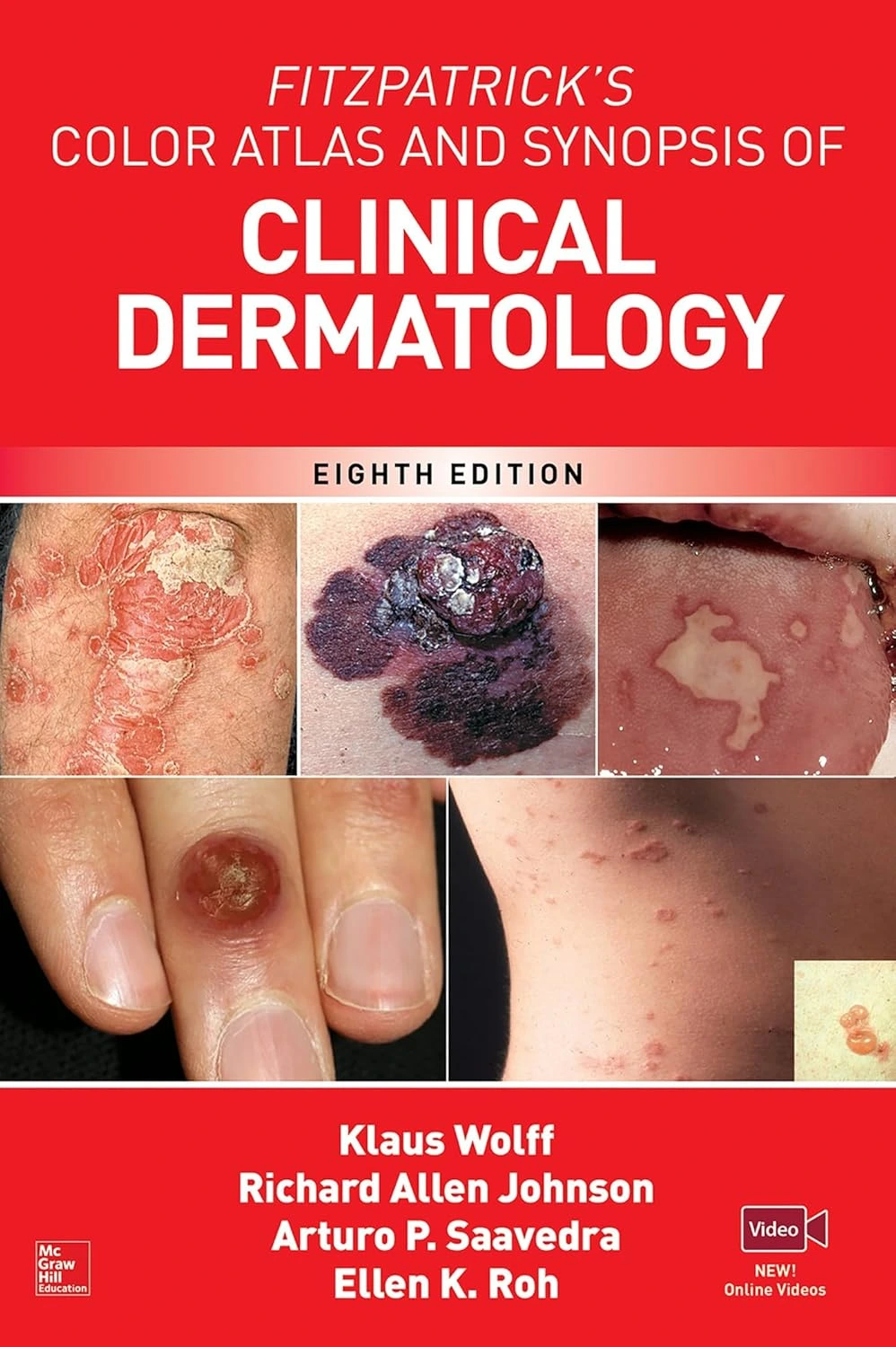 Fitzpatricks Color Atlas N Synopsis Of Clinical Dermatology 8th Edition (Ie) | Paperback