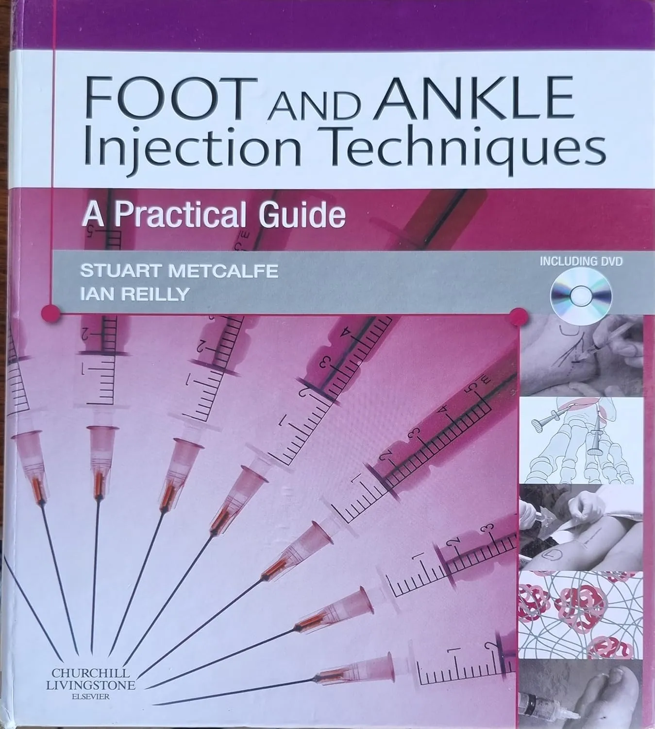 Foot And Ankle Injection Techniques A Practical Guide | Hardcover