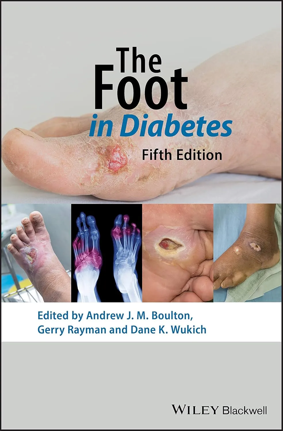 The Foot In Diabetes 5th Edition | Hardcover