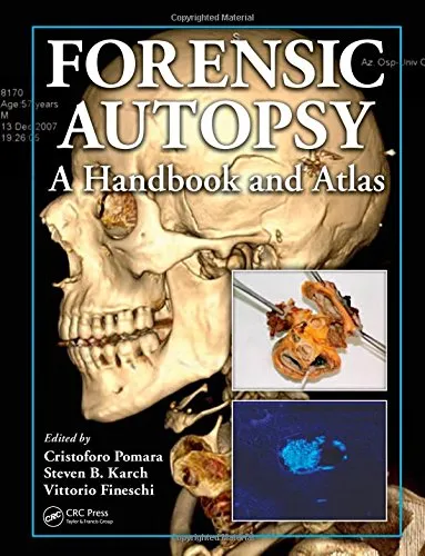 Forensic Autopsy A Handbook and Atlas | Hardcover