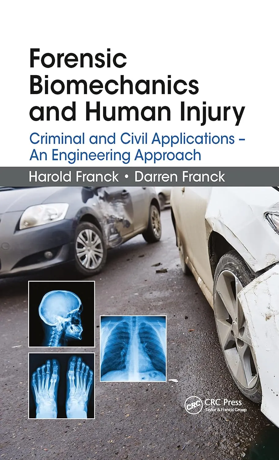 Forensic Biomechanics And Human Injury Criminal And Civil Applications An Engineering Approach | Paperback