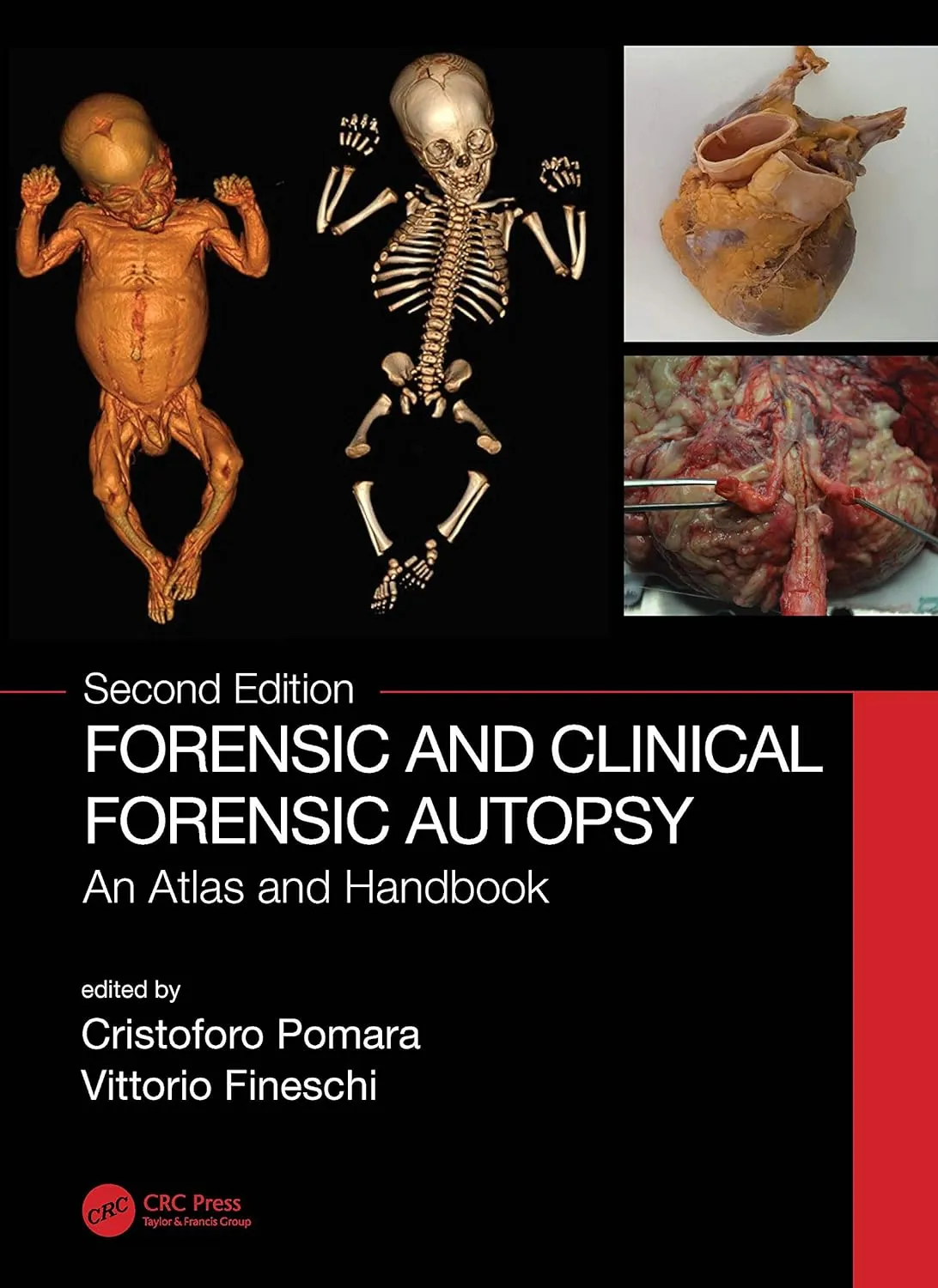 Forensic And Clinical Forensic Autopsy An Atlas And Handbook 2nd Edition | Hardcover
