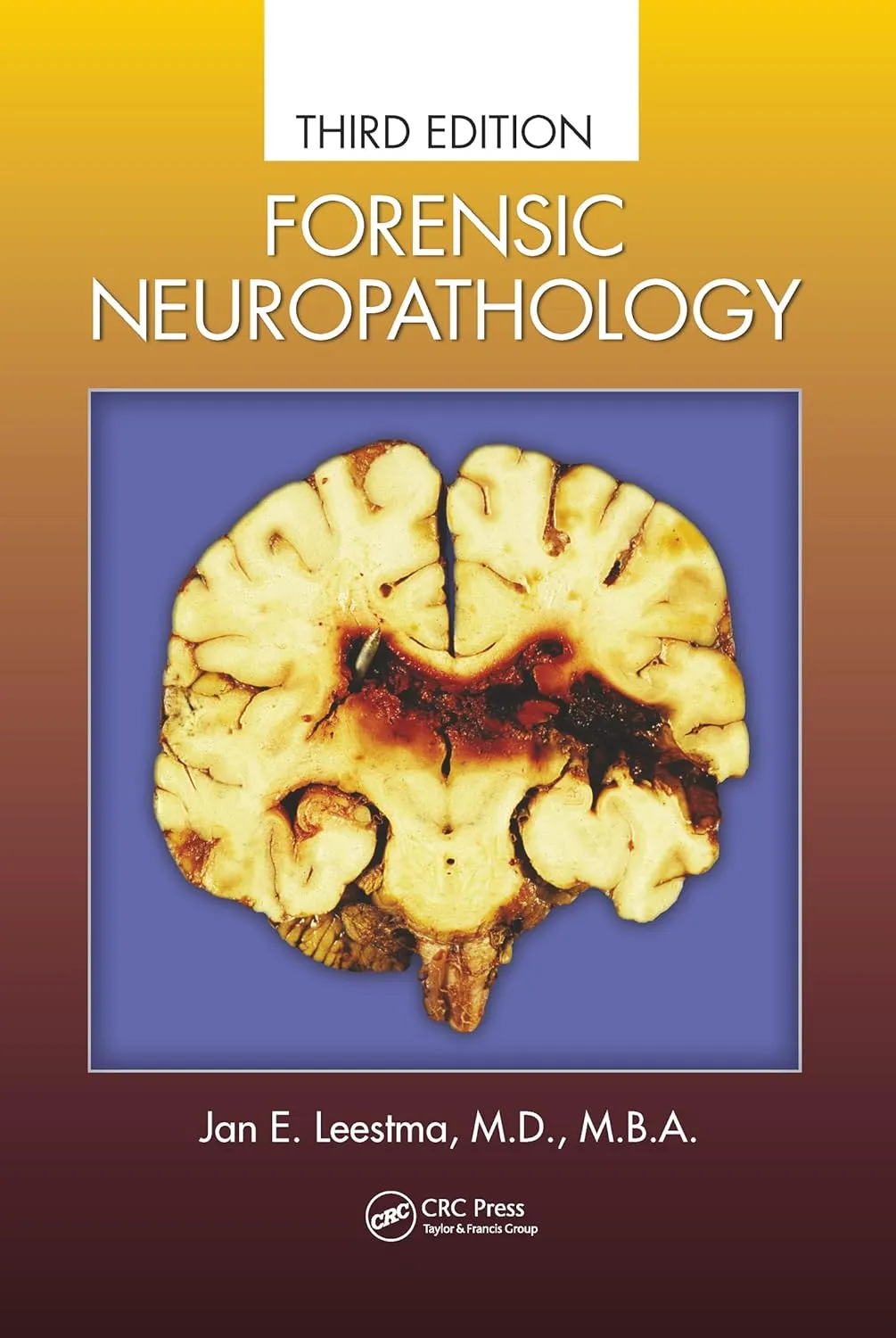 Forensic Neuropathology Third Edition | Paperback
