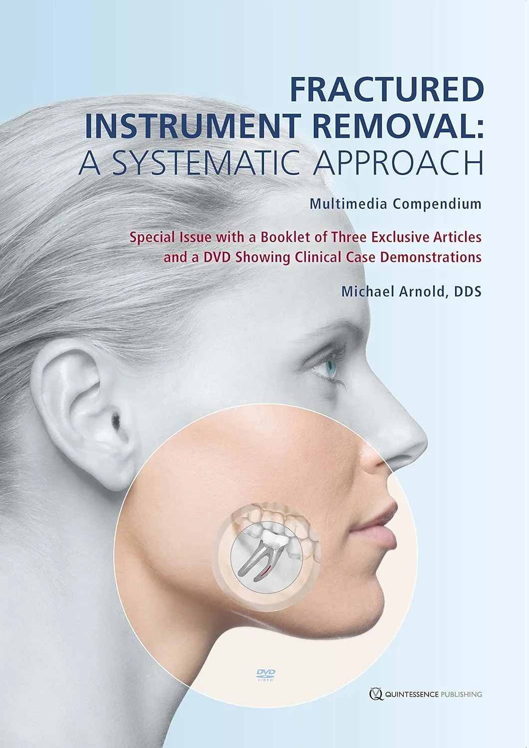 Fractures Instrument Removal A Systematic Approach | Hardcover