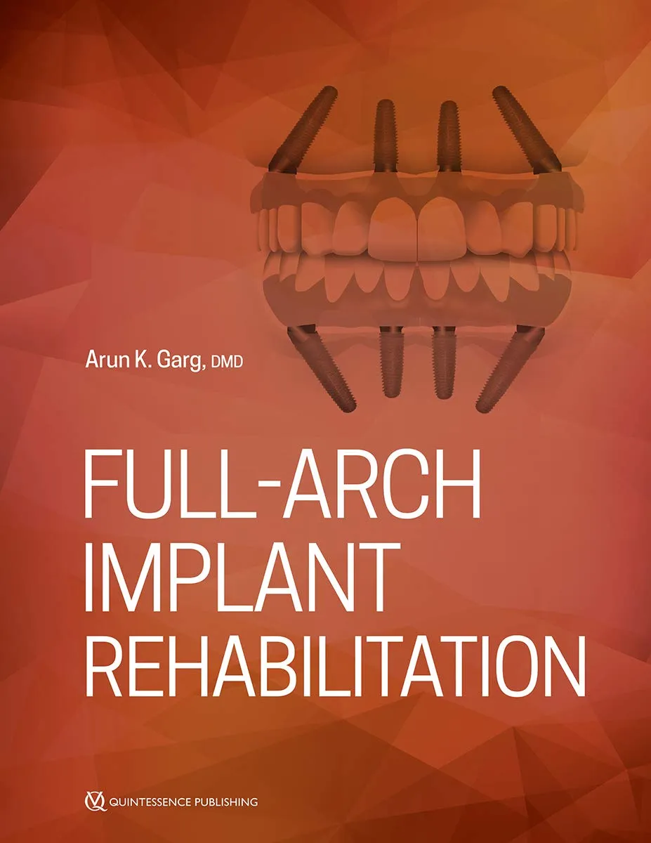 Full-Arch Implant Rehabilitation | Paperback