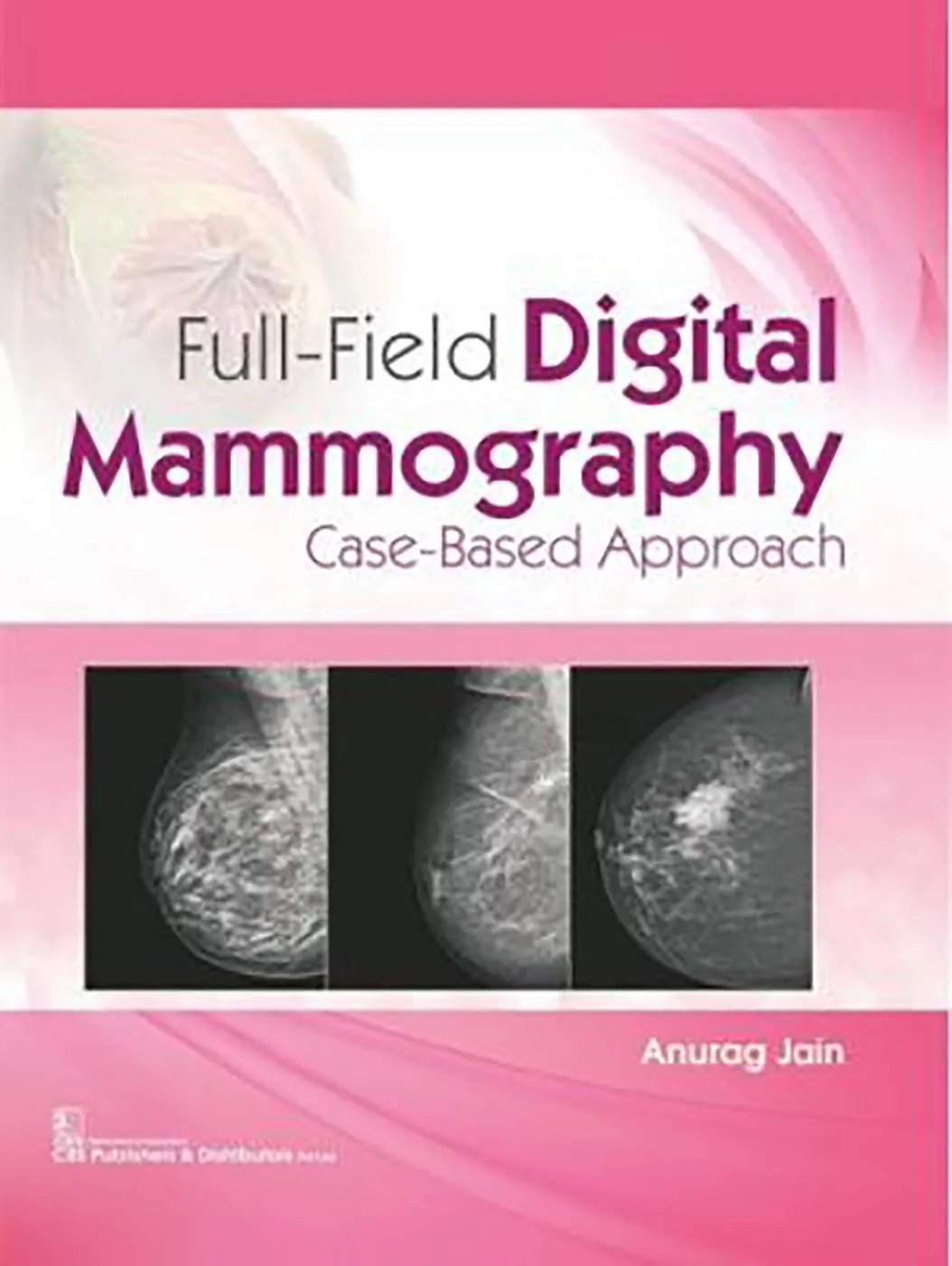 Full-Field Digital Mammography Case-Based Approach | Hardcover