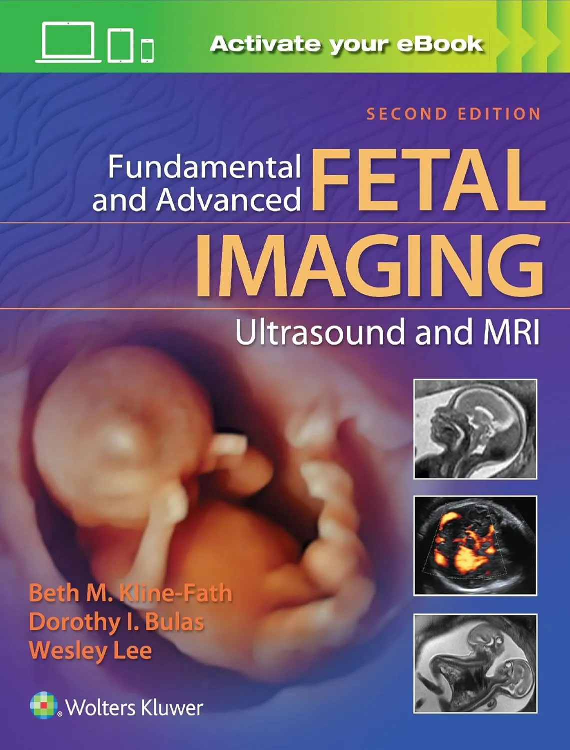 Fundamental and Advanced Fetal Imaging Ultrasound and MRI | 2nd Edition | Hardcover