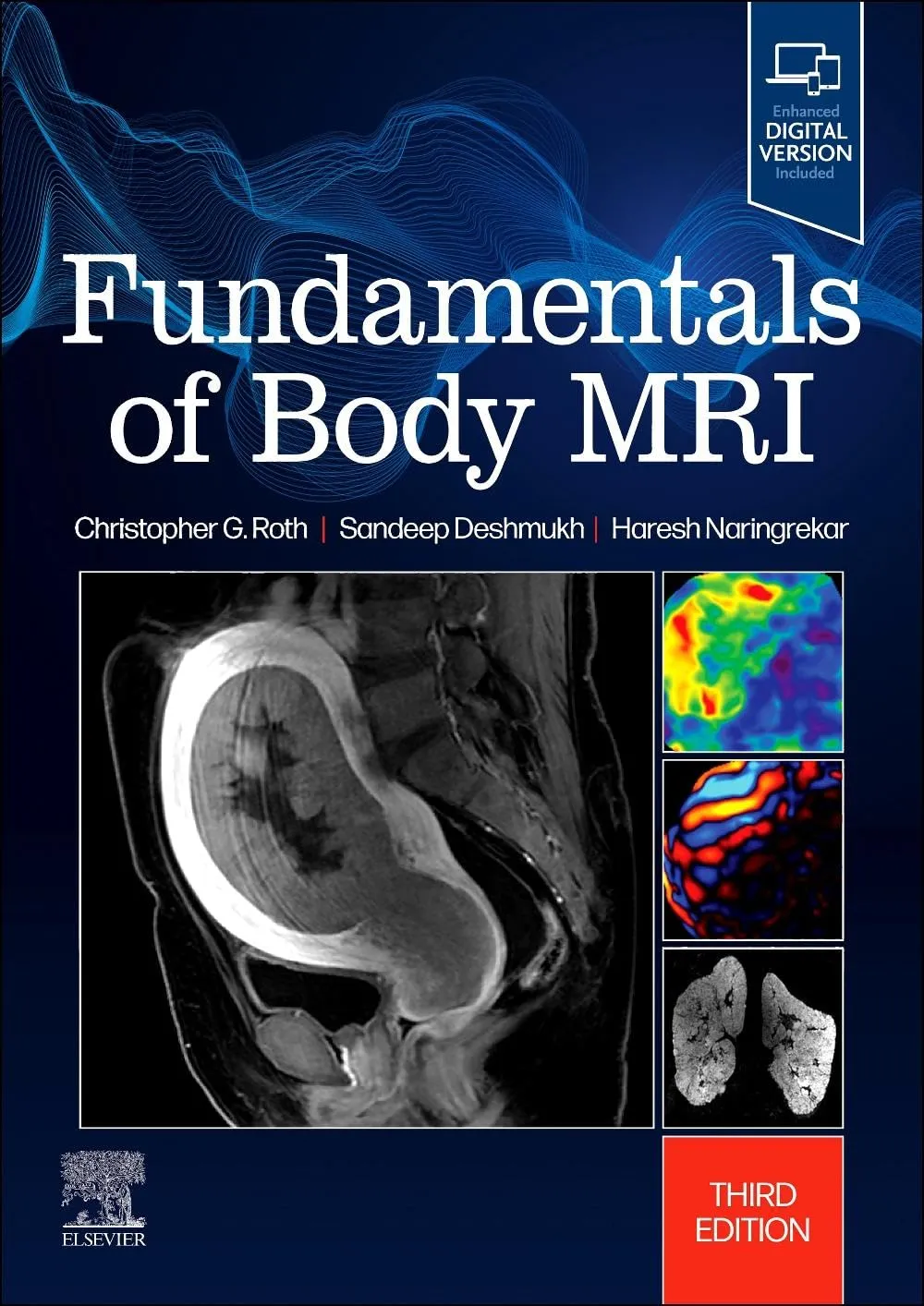 Fundamentals Of Body Mri With Access Code Third Editiond | Paperback