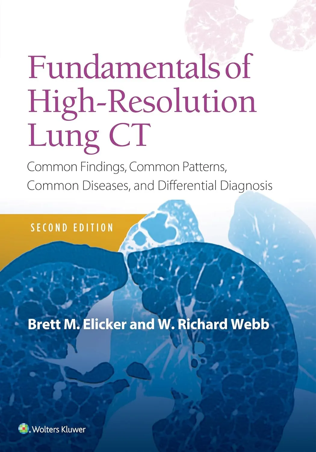 Fundamentals of High-Resolution Lung CT | 2nd Edition | Paperback