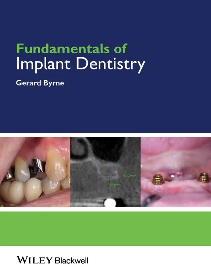 Fundamentals of Implant Dentistry | Paperback