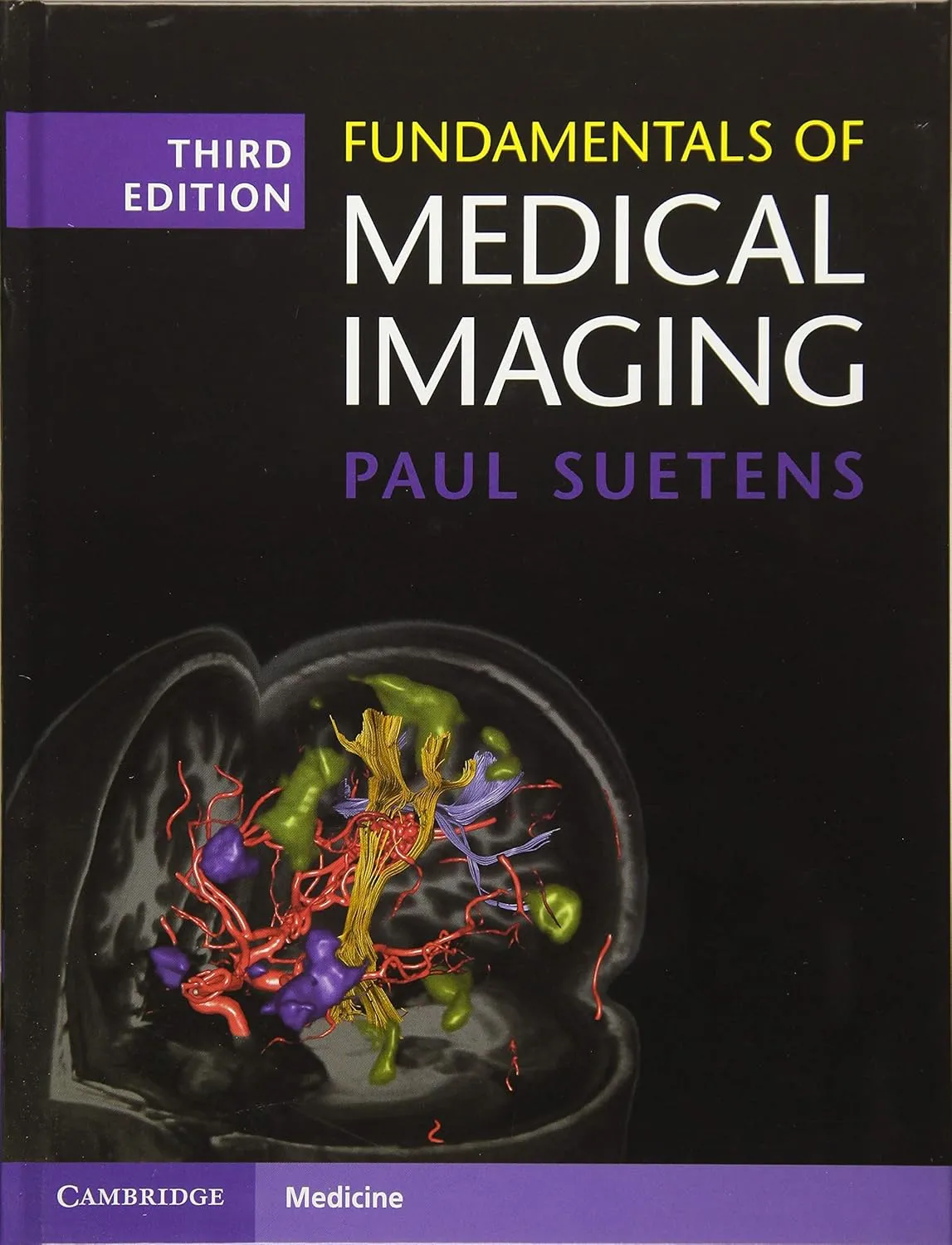 Fundamentals of Medical Imaging | Third Edition | Hardcover