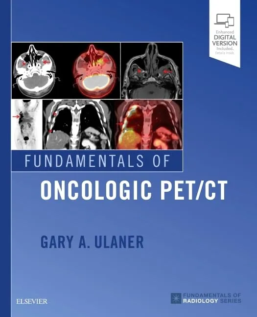 Fundamentals Of Oncologic Pet CT | Paperback