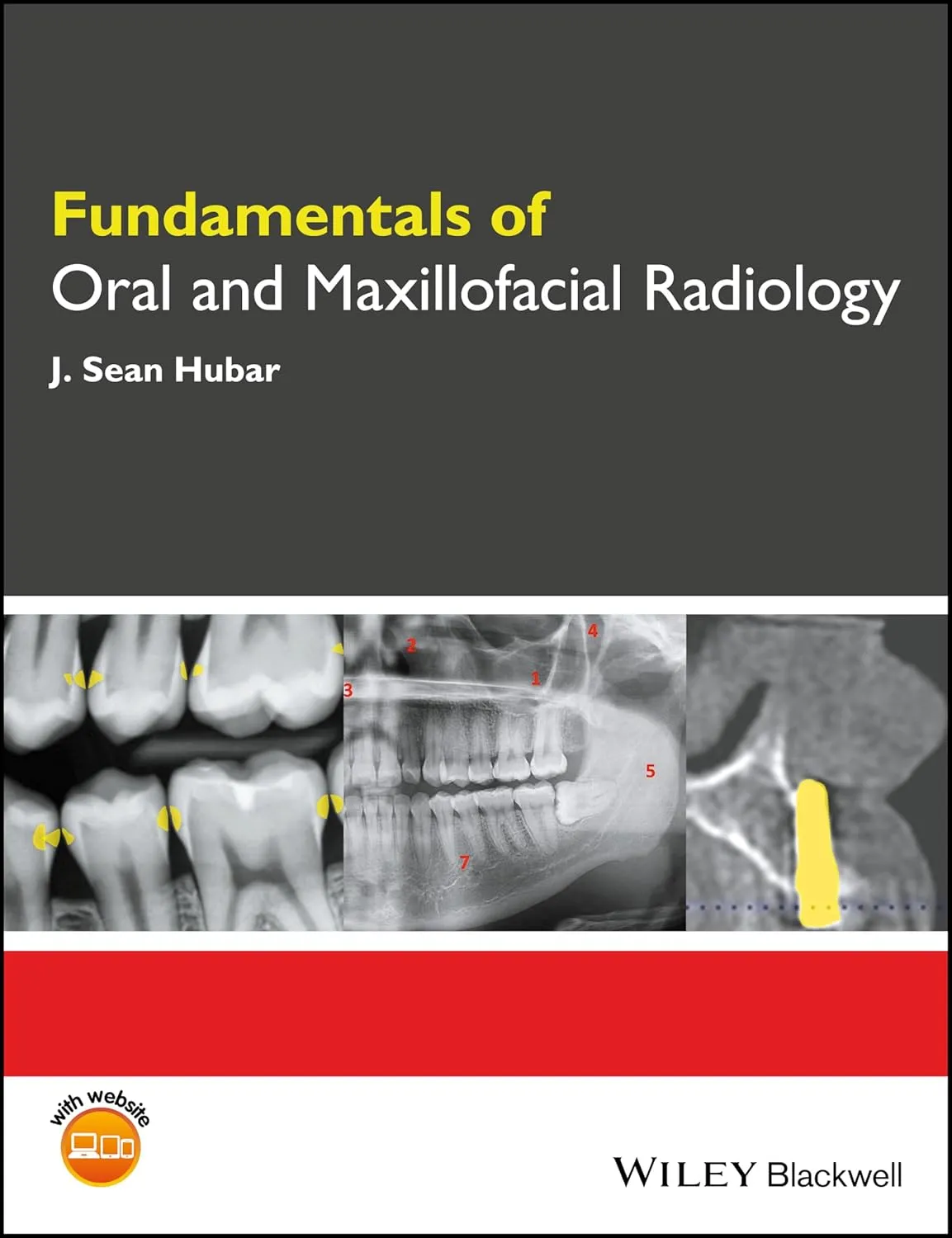 Fundamentals of Oral and Maxillofacial Radiology | Paperback