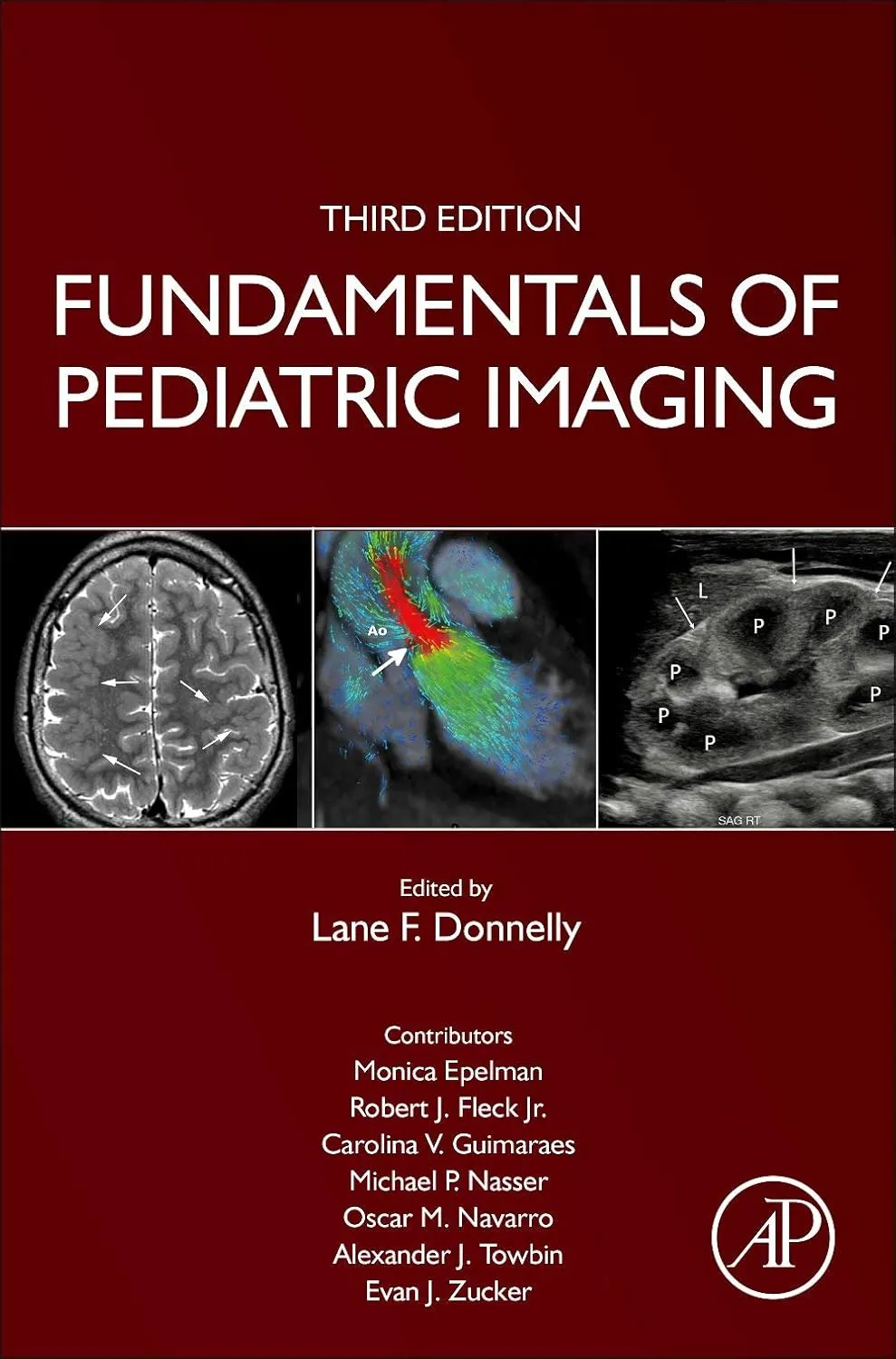 Fundamentals Of Pediatric Imaging Third Edition | Hardcover