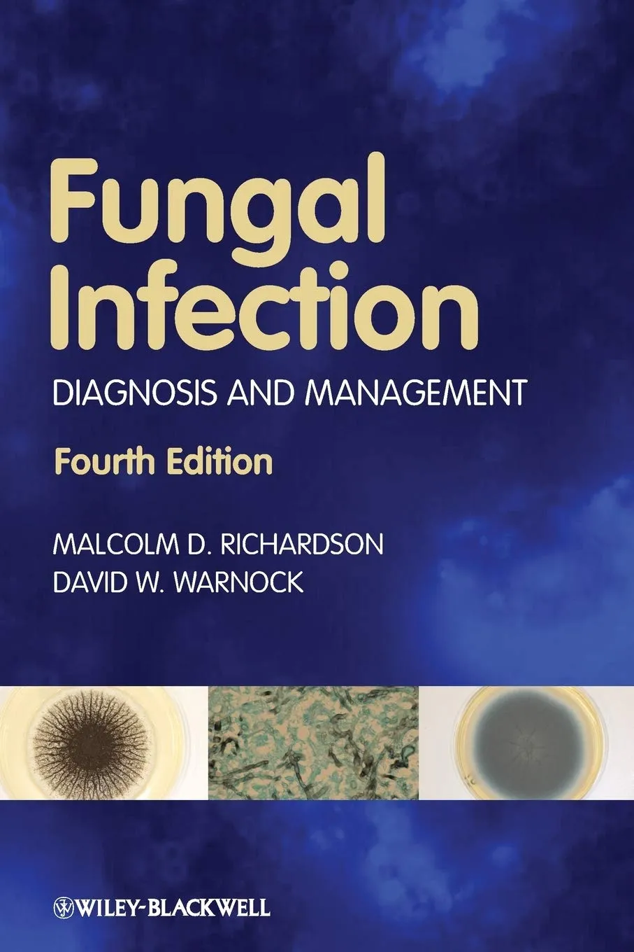 Fungal Infection Diagnosis and Management | 4th Edition | Paperback